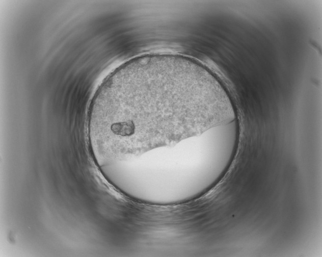 X0000099311240200805301147