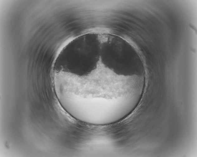 X0000099311248200805301148