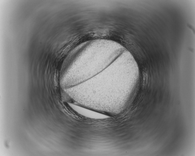 X0000099311250200805301147