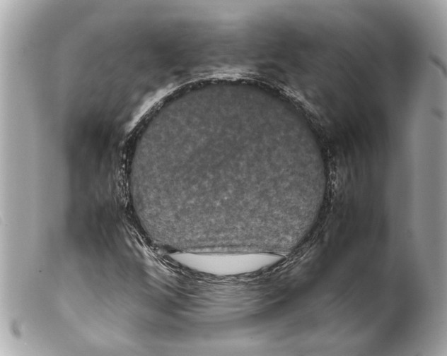 X0000099311256200805301147