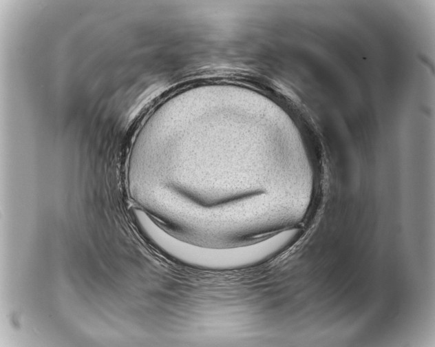 X0000099311259200805301147