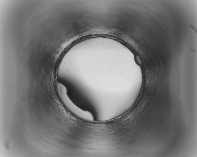 X0000099311264200805301147