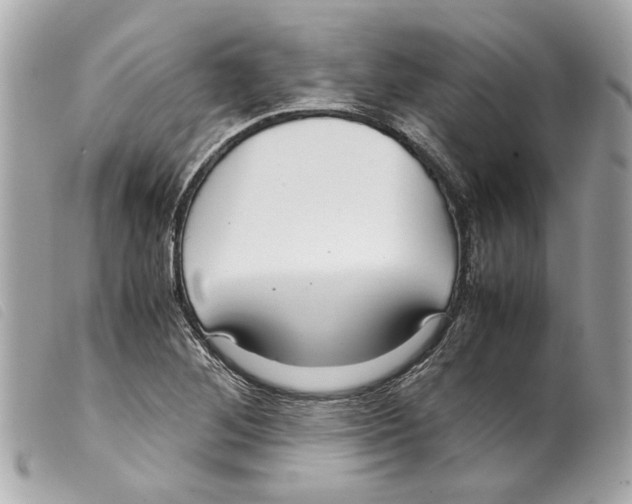 X0000099311268200805301147