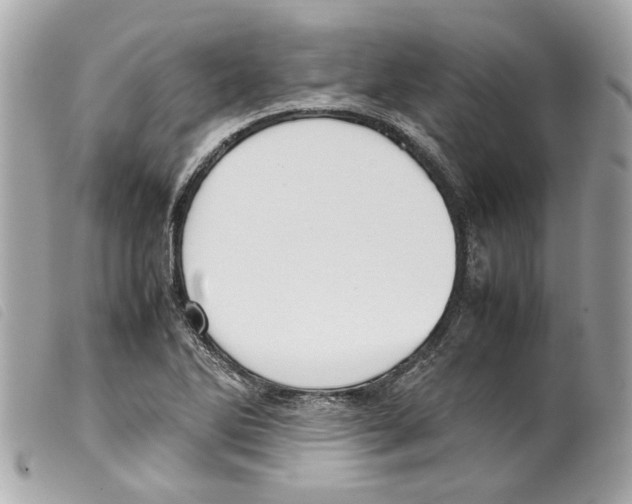 X0000099311270200805301147