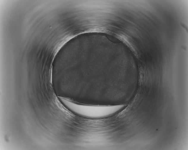 X0000099311276200805301146