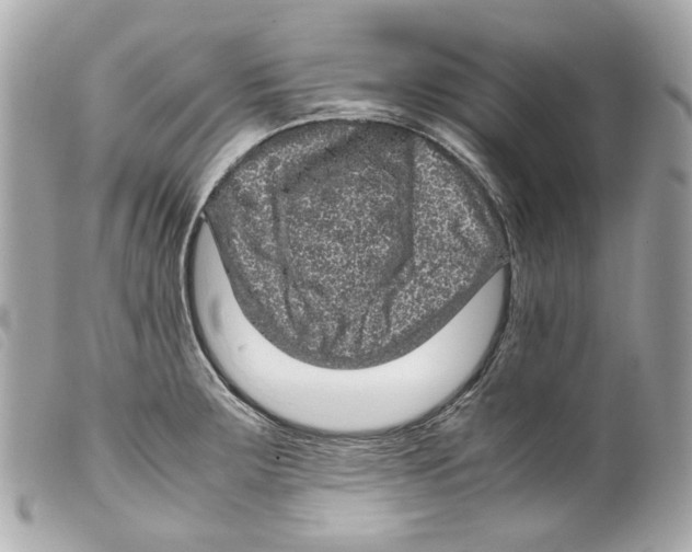 X0000099311283200805301146