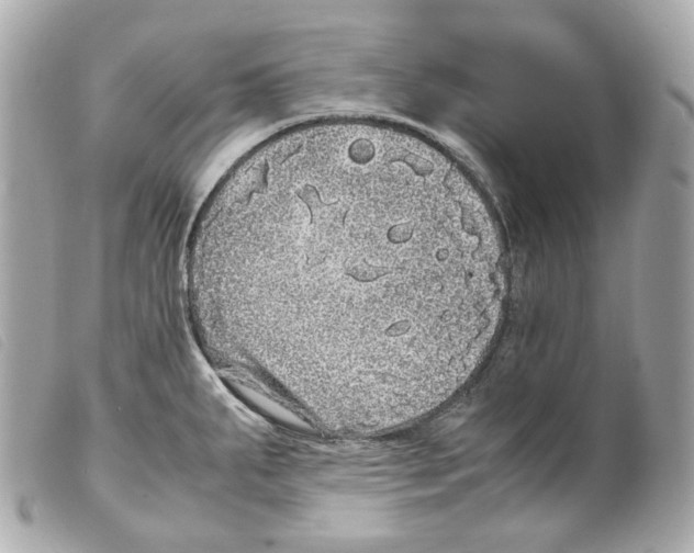 X0000099311287200805301146