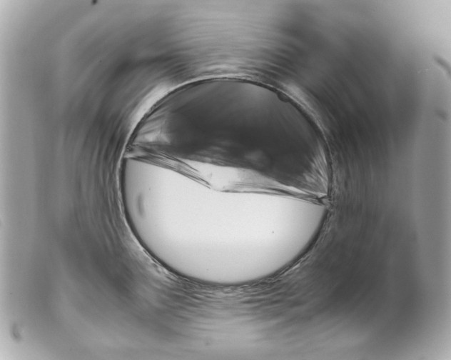 X0000099311291200805301146