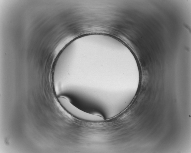 X0000099311293200805301146