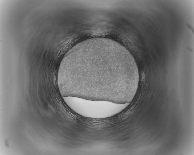 X0000099311300200805301146