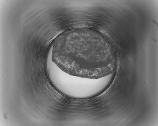 X0000099311305200805301146