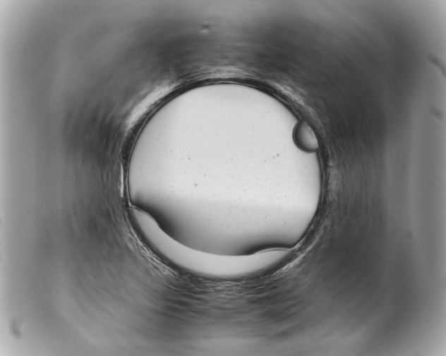 X0000099311317200805301146