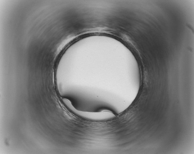 X0000099311320200805301146