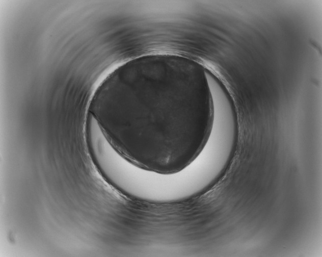 X0000099311331200805301146