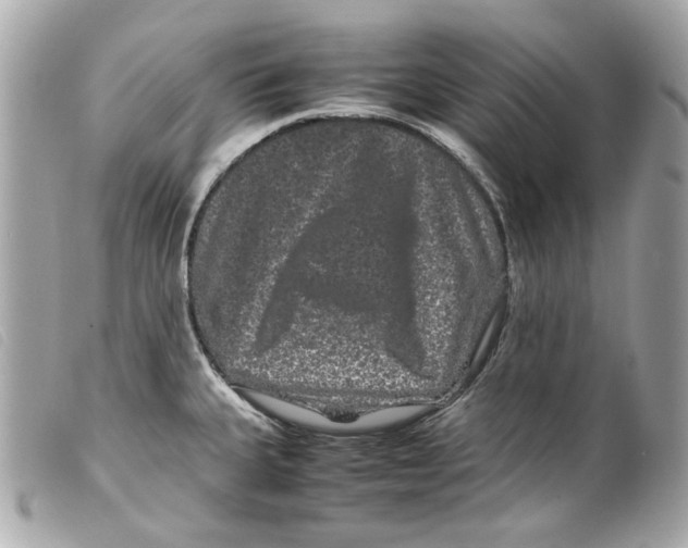 X0000099311335200805301146