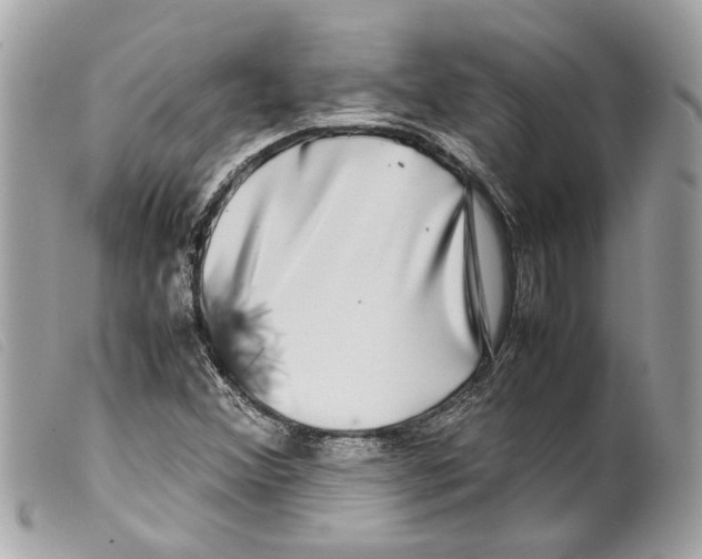 X0000099311356200805301145