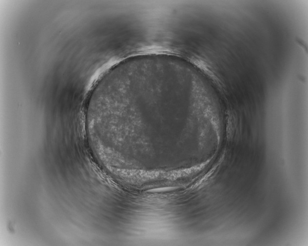 X0000099311358200805301145