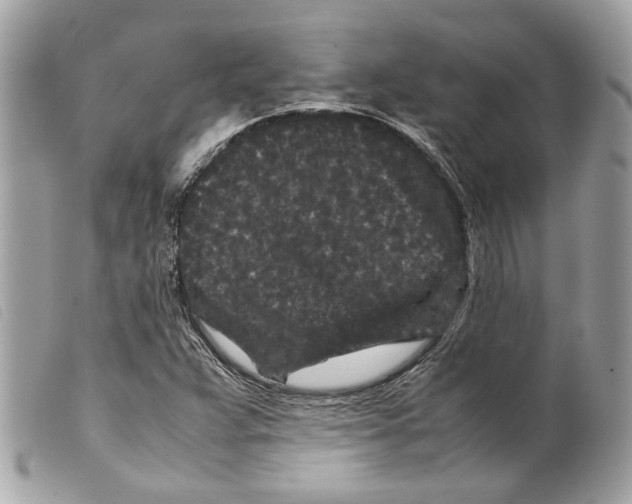 X0000099311359200805301145