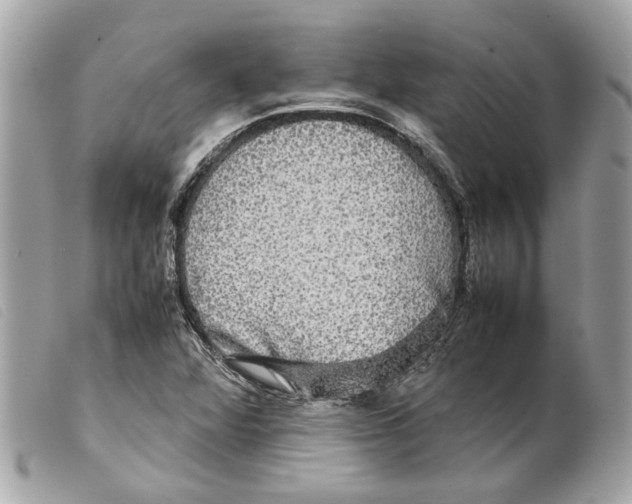 X0000099311360200805301145