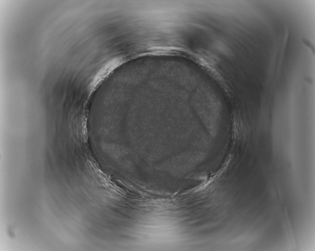 X0000099311362200805301145