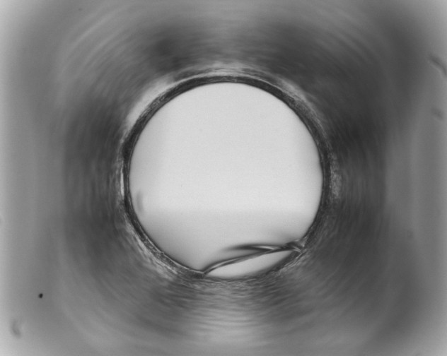 X0000099311368200805301145