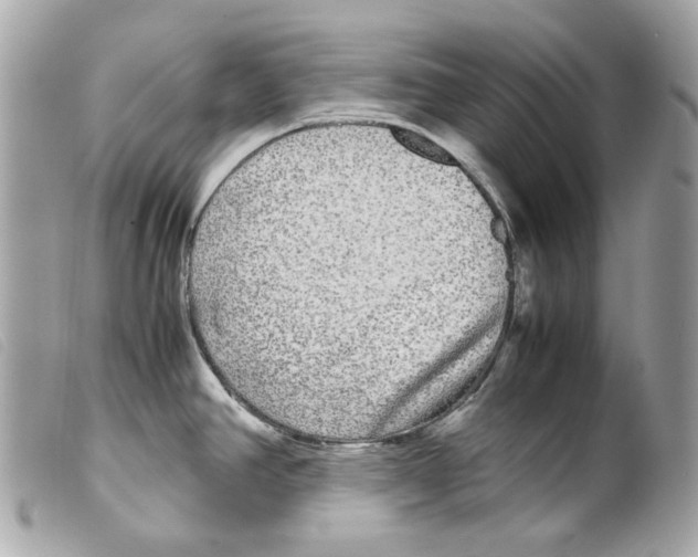 X0000099311390200805301145