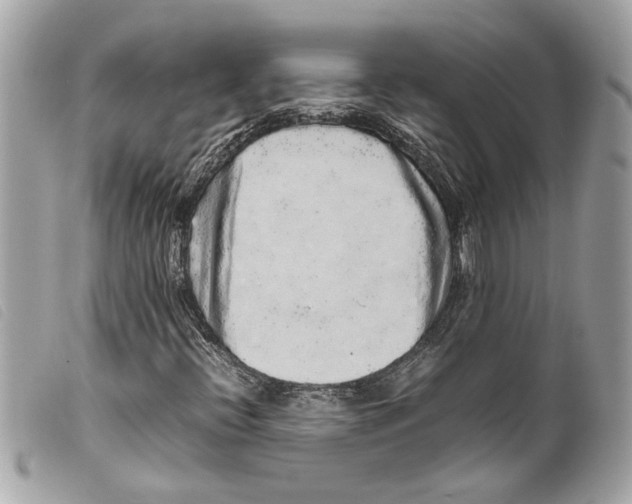 X0000099311396200805301144