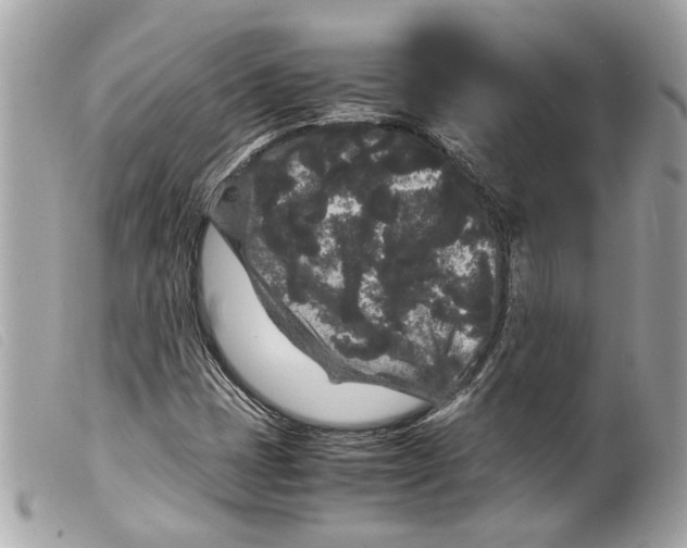 X0000099311401200805301144