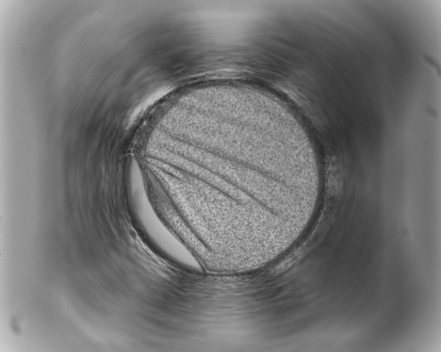 X0000099311402200805301144