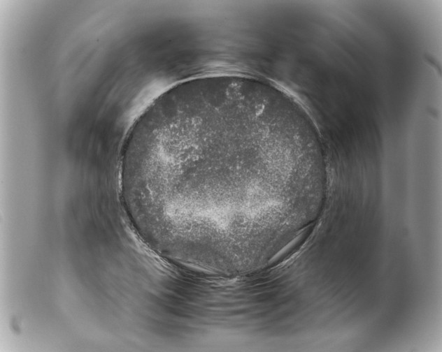 X0000099311415200805301145