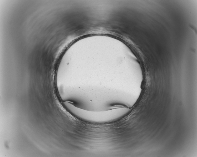 X0000099311416200805301145