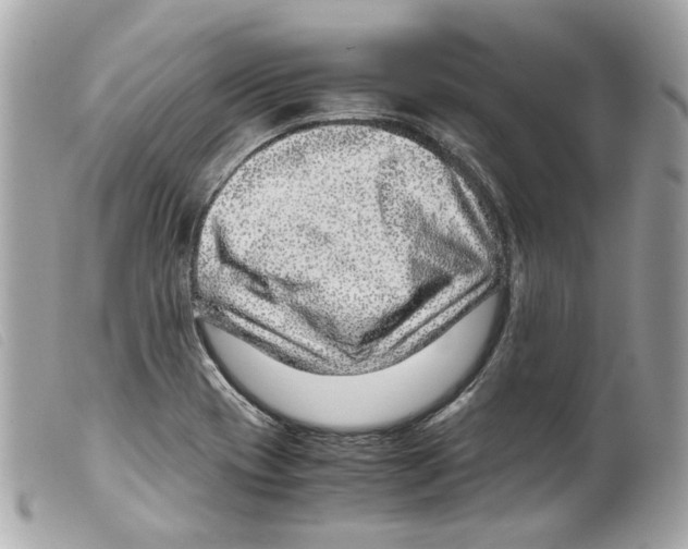 X0000099311417200805301145