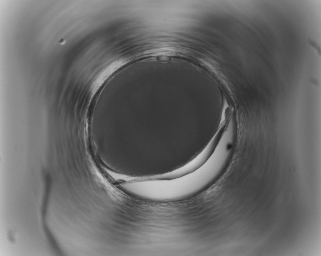 X0000099311418200805301145