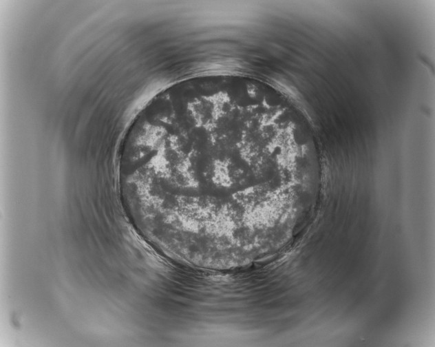 X0000099311419200805301145