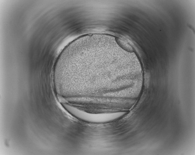 X0000099311432200805301145