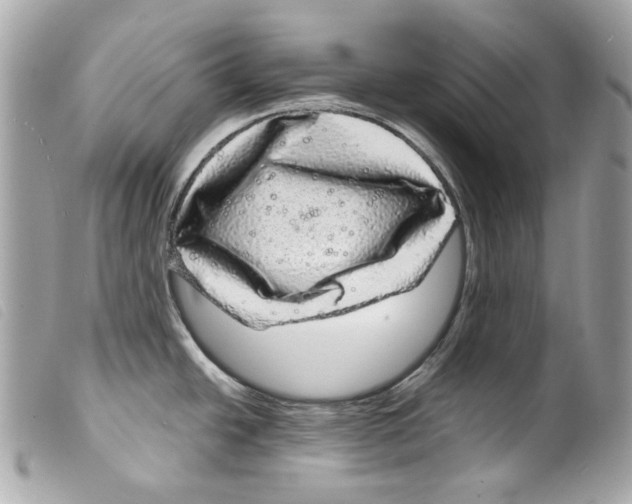 X0000099311438200805301145