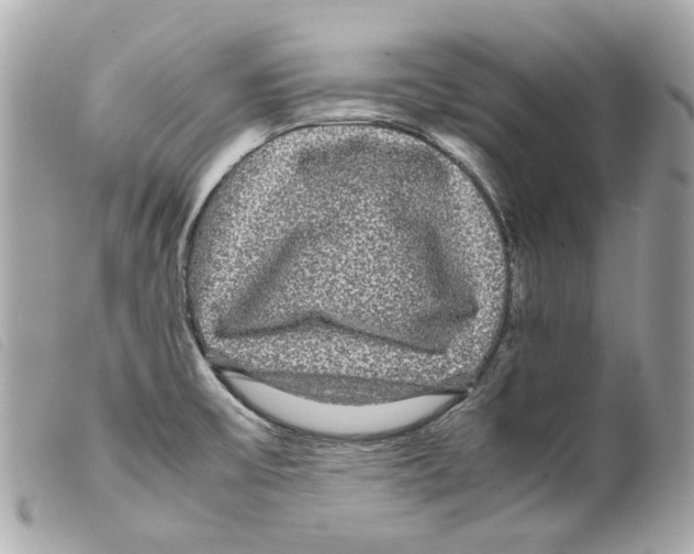 X0000099311475200805301144