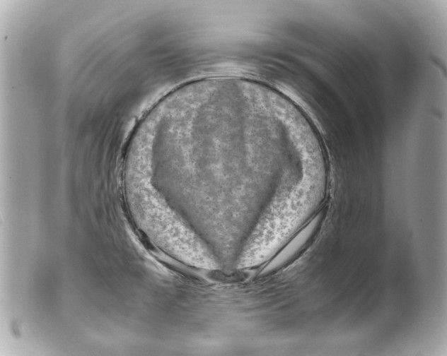 X0000099311477200805301144