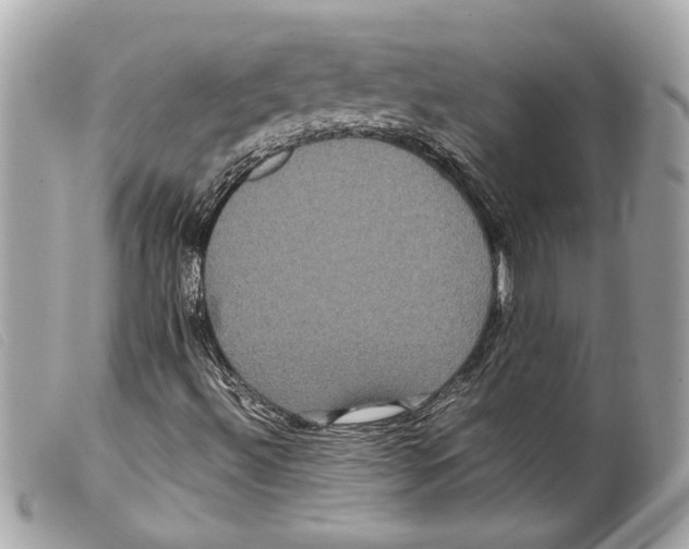 X0000099311492200805301143