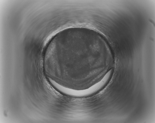 X0000099311506200805301143