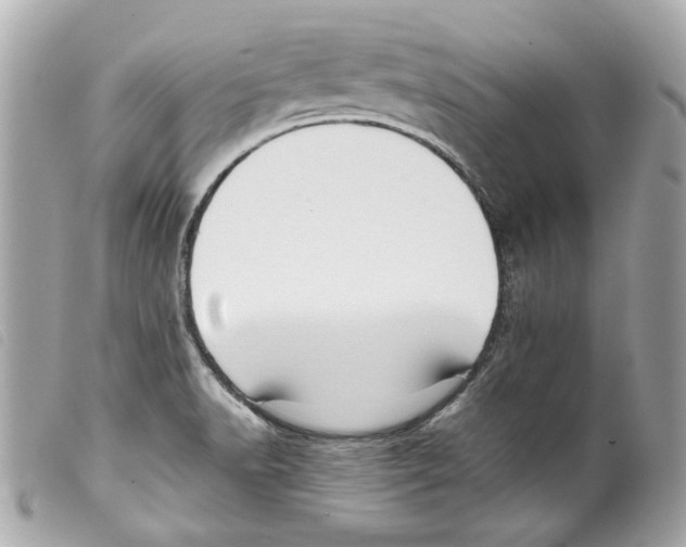 X0000099311518200805301143