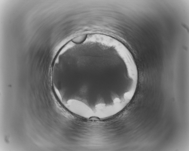 X0000099311522200805301143