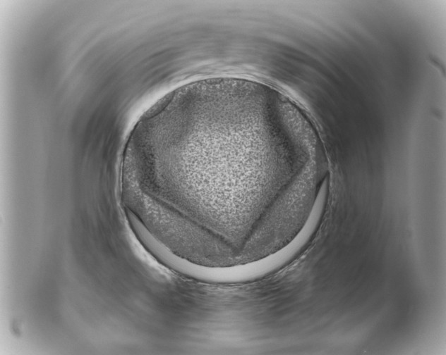 X0000099311528200805301143