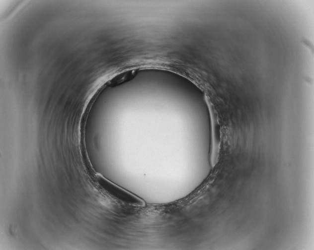 X0000099320148200805020800