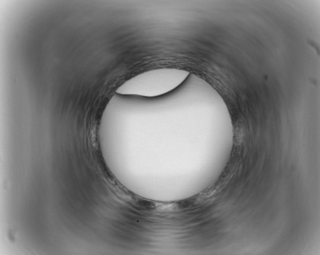 X0000099320185200805020801