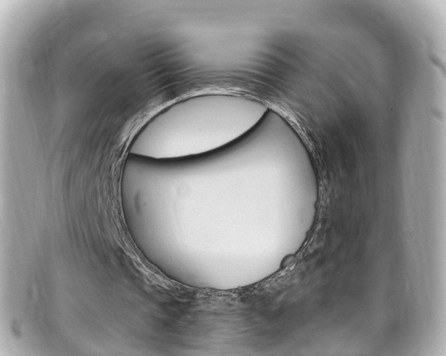 X0000099320337200805020758