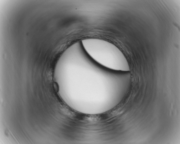 X0000099320466200805020757