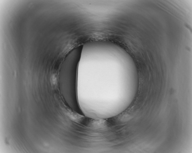 X0000099320576200805020756