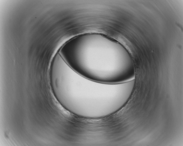 X0000099321140200805020747