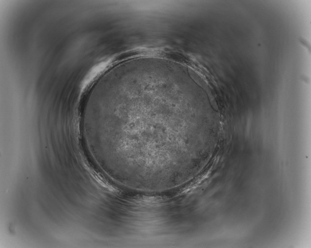 X0000099320149200805021321